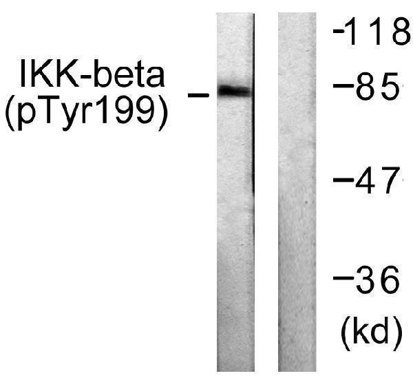 a00118y199 1 ikbkb primary antibodies wb testing 2