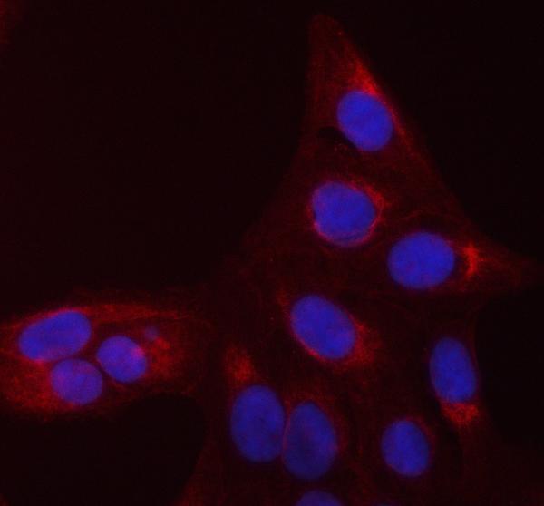  IF analysis of CDC42 using anti-CDC42 antibody (A00119-1)