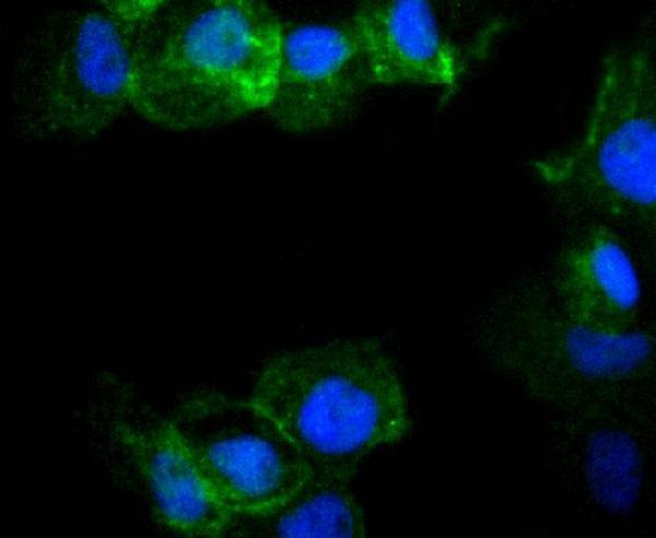 ICC staining Phospho-Rac1+Cdc42(Ser71) in A431 cells (green)