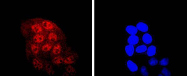 ICC staining KLF4 in Hela cells (red)