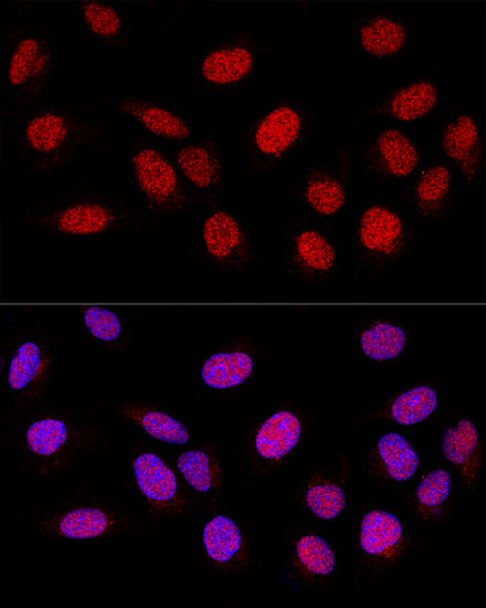 Confocal immunofluorescence analysis of U-2 OS cells using PARP1 Polyclonal Antibody  at dilution of 1:200