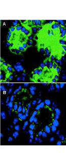 Immunofluorescence microscopy of IL-18 in mouse colon sections
