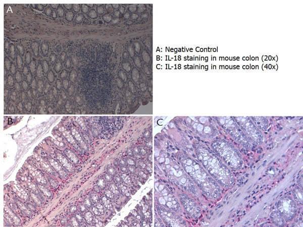 Immunohistochemistry with Rabbit anti-Mouse IL-18 antibody showing IL-18 staining in inflammatory cells of the mucous corium of mouse colon at 20x and 40x