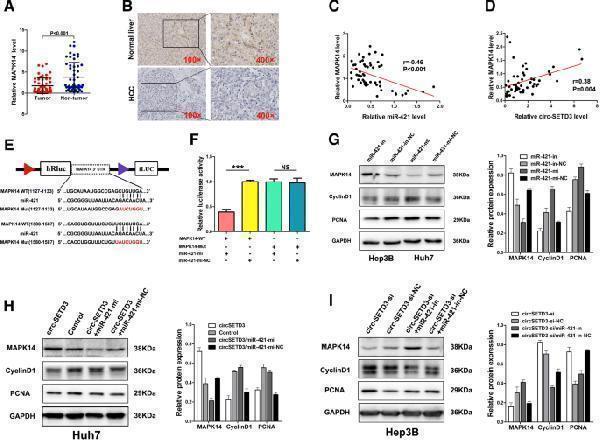 CircSETD3 inhibits the growth of HCC through thecircSETD3/miR-421/MAPK14 pathway