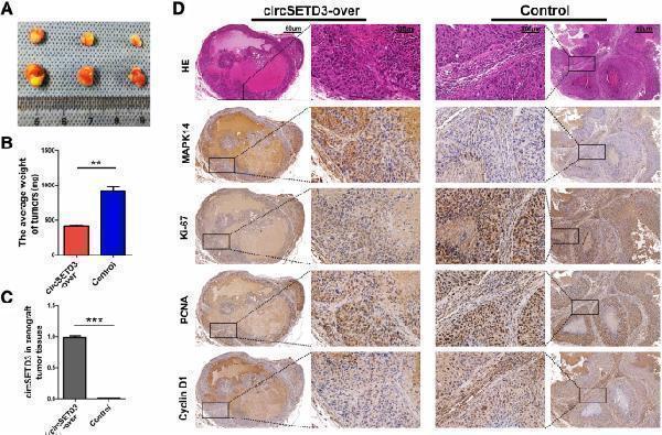 CircSETD3 stably maintained in xenograft tumor models and inhibit tumor growth by targeting MAPK14