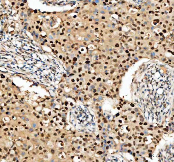 a00125 pcna primary antibodies ihc testing 2