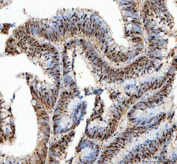 a00125 pcna primary antibodies ihc testing 3