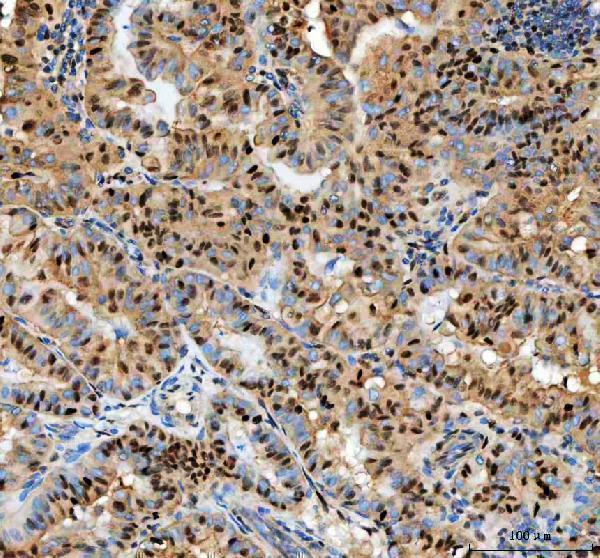 a00125 pcna primary antibodies ihc testing 5