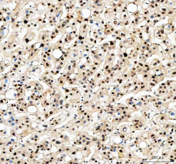 a00125 pcna primary antibodies ihc testing 7