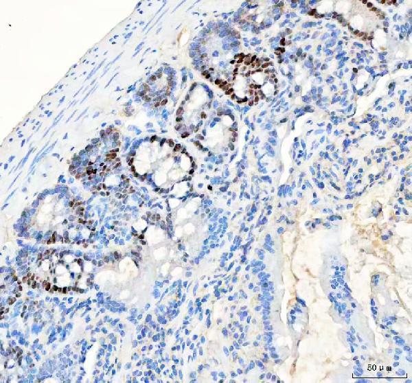 a00125 pcna primary antibodies ihc testing 8