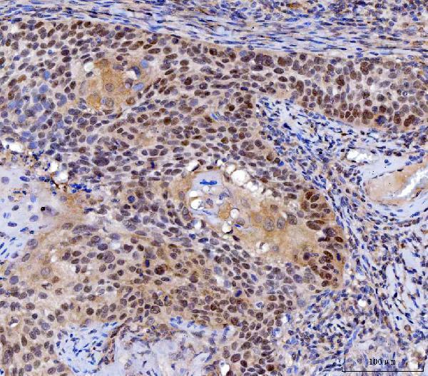  IHC analysis of MLH1 using anti-MLH1 antibody (A00126-1)