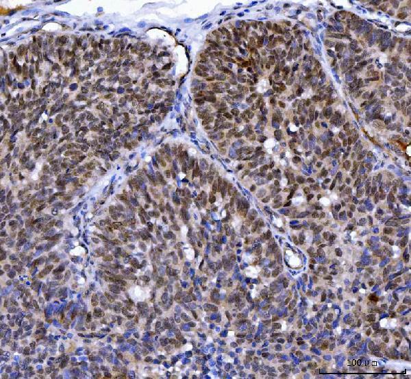  IHC analysis of MLH1 using anti-MLH1 antibody (A00126-1)