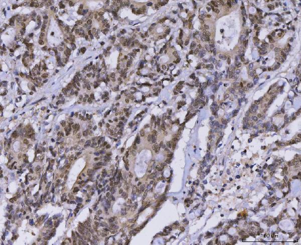 a00126 1 mlh1 primary antibodies ihc testing 4