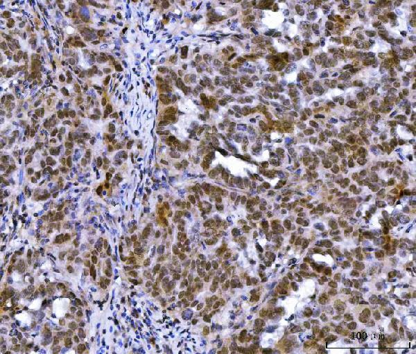 a00126 1 mlh1 primary antibodies ihc testing 5