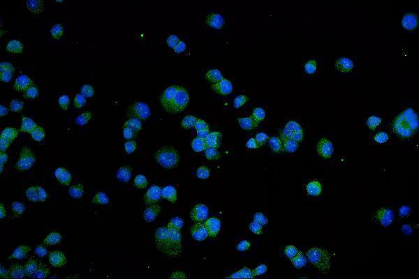 a00128 4 trpv1 primary antibodies if testing 2