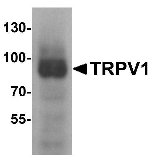 a00128 trpv1 primary antibodies wb testing 1