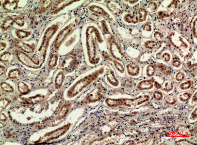 Immunohistochemical analysis of paraffin-embedded human-kidney, antibody was diluted at 1:100
