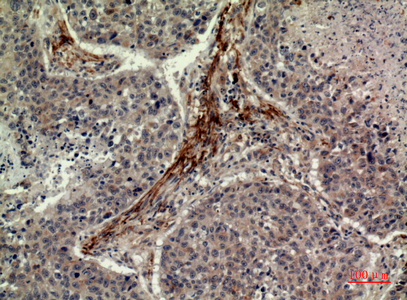 Immunohistochemical analysis of paraffin-embedded human-lung, antibody was diluted at 1:100