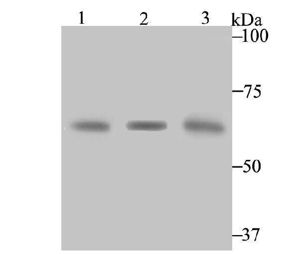 Western blot analysis of CBS on different lysates using anti-CBS antibody at 1/1,000 dilution