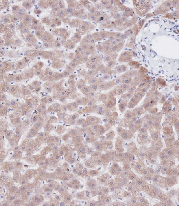 a00130 2 anti cbs antibody center ihc p leica testing 4
