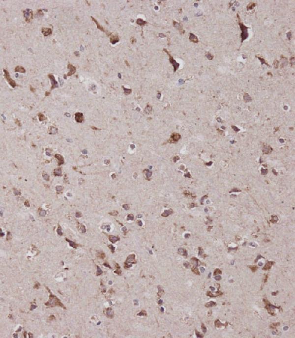 a00130 2 anti cbs antibody center ihc p leica testing 5