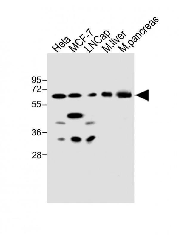 All lanes : Anti-CBS Antibody (Center) at 1:500 dilutionLane 1: Hela whole cell lysateLane 2: MCF-7 whole cell lysateLane 3: LNCap whole cell lysateLane 4: mouse liver lysateLane 5: mouse pancreas lysateLysates/proteins at 20 µg per lane