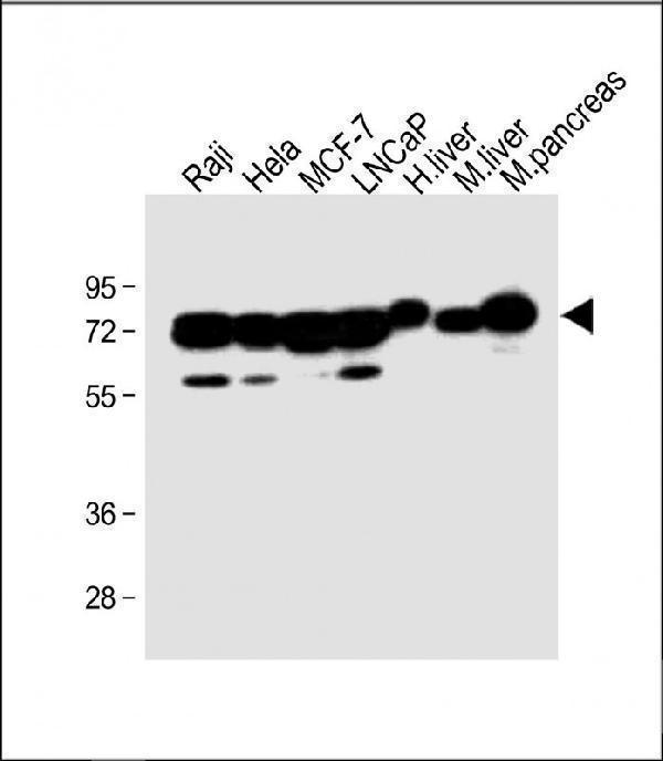 All lanes : Anti-CBS Antibody (Center) at 1:2000 dilutionLane 1: Raji whole cell lysateLane 2: Hela whole cell lysateLane 3: MCF-7 whole cell lysateLane 4: LNCaP whole cell lysateLane 5: Human liver lysateLane 6: Mouse liver lysateLane 7: Mouse pancreas lysateLysates/proteins at 20 µg per lane