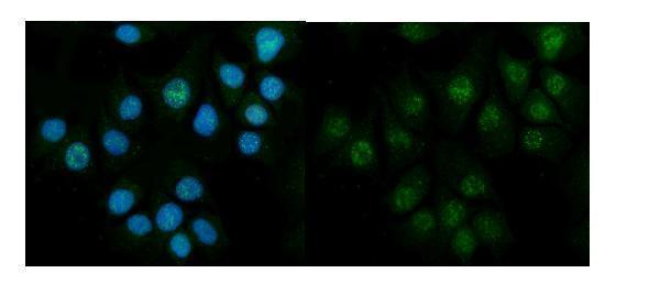  IF analysis of CBS using anti-CBS antibody (A00130-3)