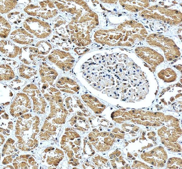 IHC analysis of CBS using anti-CBS antibody (A00130-3)