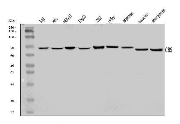  Western blot analysis of CBS using anti-CBS antibody (A00130-3)