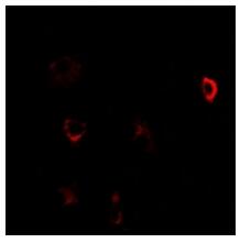 a00130 cbs primary antiboties if testing 2