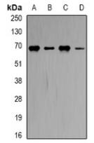 a00130 cbs primary antiboties wb testing 1