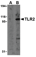 a00131 1 tlr2 primary antibodies wb testing 1