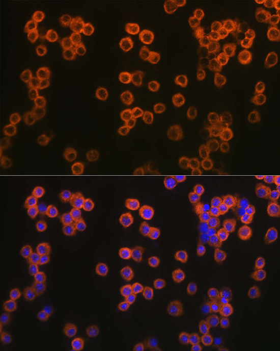 a00131 3 tlr2 primary antiboties if testing 2