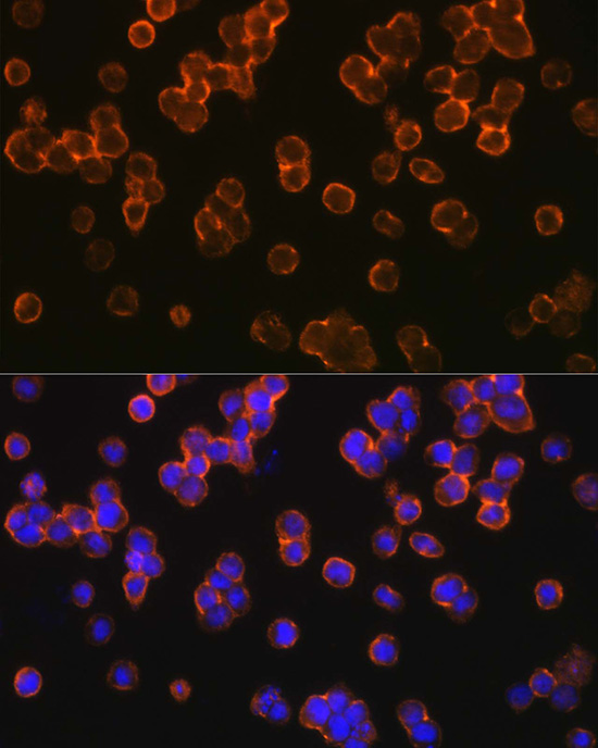 a00131 3 tlr2 primary antiboties if testing 3