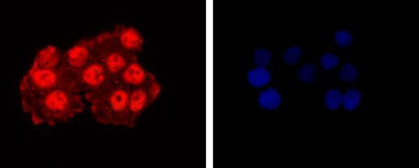 ICC staining CTCF in Hela cells (red)