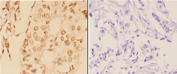 a00133 abl1 primary antiboties ihc testing 2