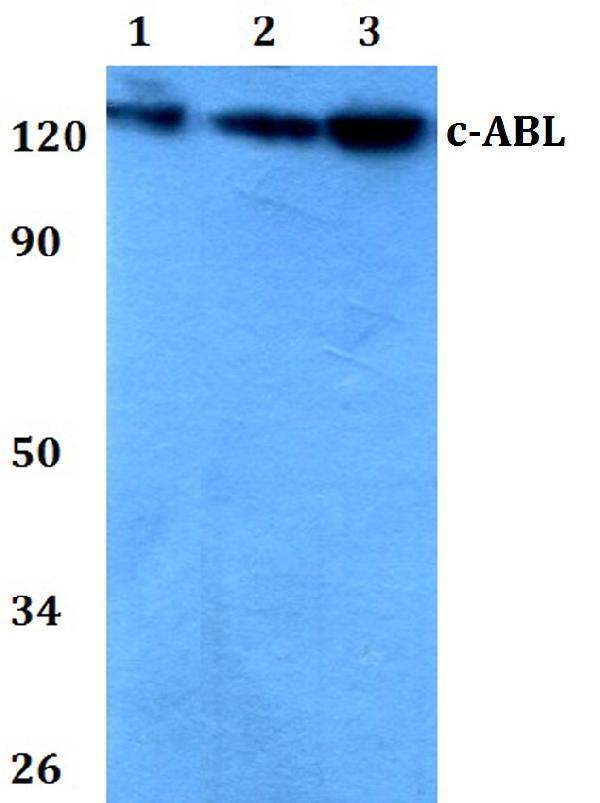 a00133 abl1 primary antiboties wb testing 1