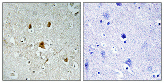 a00133y204 abl1 primary antibodyes ihc testing 1