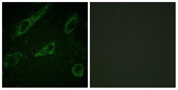 a00133y245 abl1 primary antibodies if testing 1