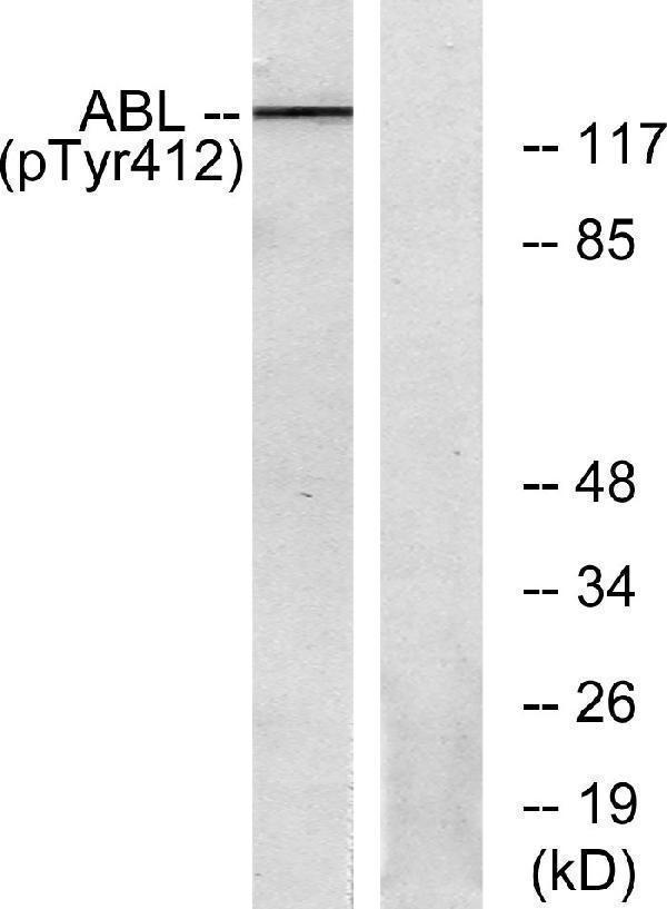 a00133y393 1 abl1 primary antibodies ihc testing 3