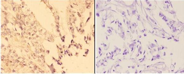 a00133y393 abl1 primary antiboties ihc testing 2