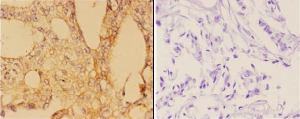 a00133y412 abl1 primary antiboties ihc testing 2