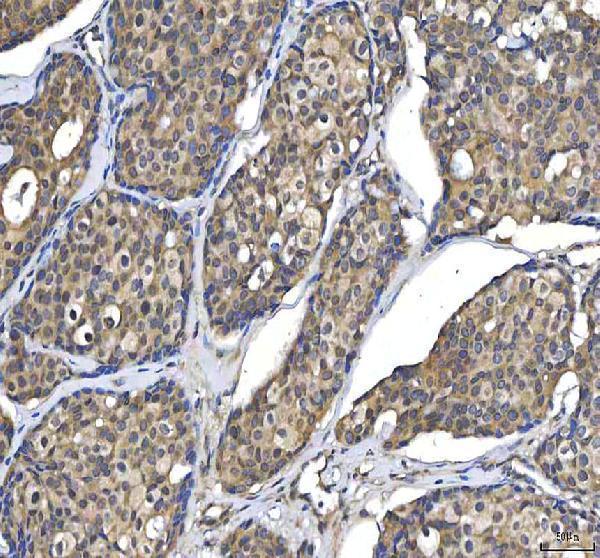 IHC analysis of Huntingtin/HTT using anti-Huntingtin/HTT antibody (A00134-2)