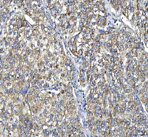  IHC analysis of Huntingtin/HTT using anti-Huntingtin/HTT antibody (A00134-2)