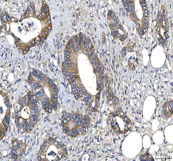  IHC analysis of Huntingtin/HTT using anti-Huntingtin/HTT antibody (A00134-2)