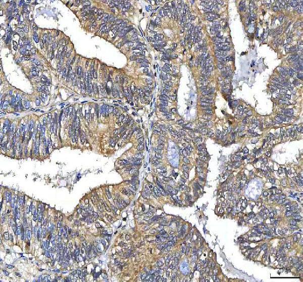 a00134 2 htt primary antibodies ihc testing 4