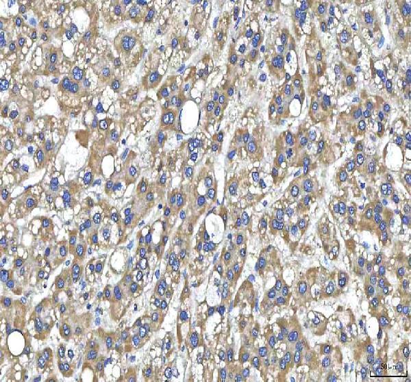 a00134 2 htt primary antibodies ihc testing 5