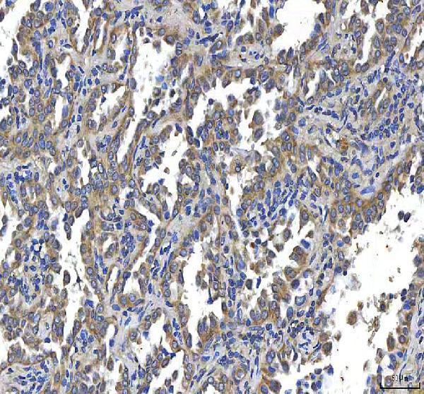 a00134 2 htt primary antibodies ihc testing 6