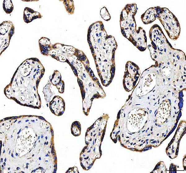 a00134 2 htt primary antibodies ihc testing 7